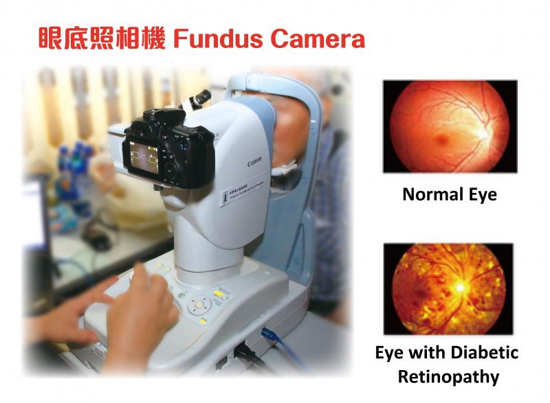 Fundus Camera